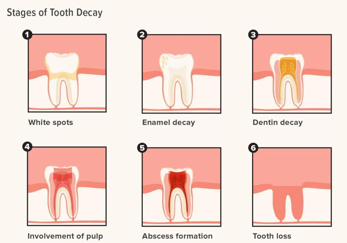 Protecting Your Oral Health 