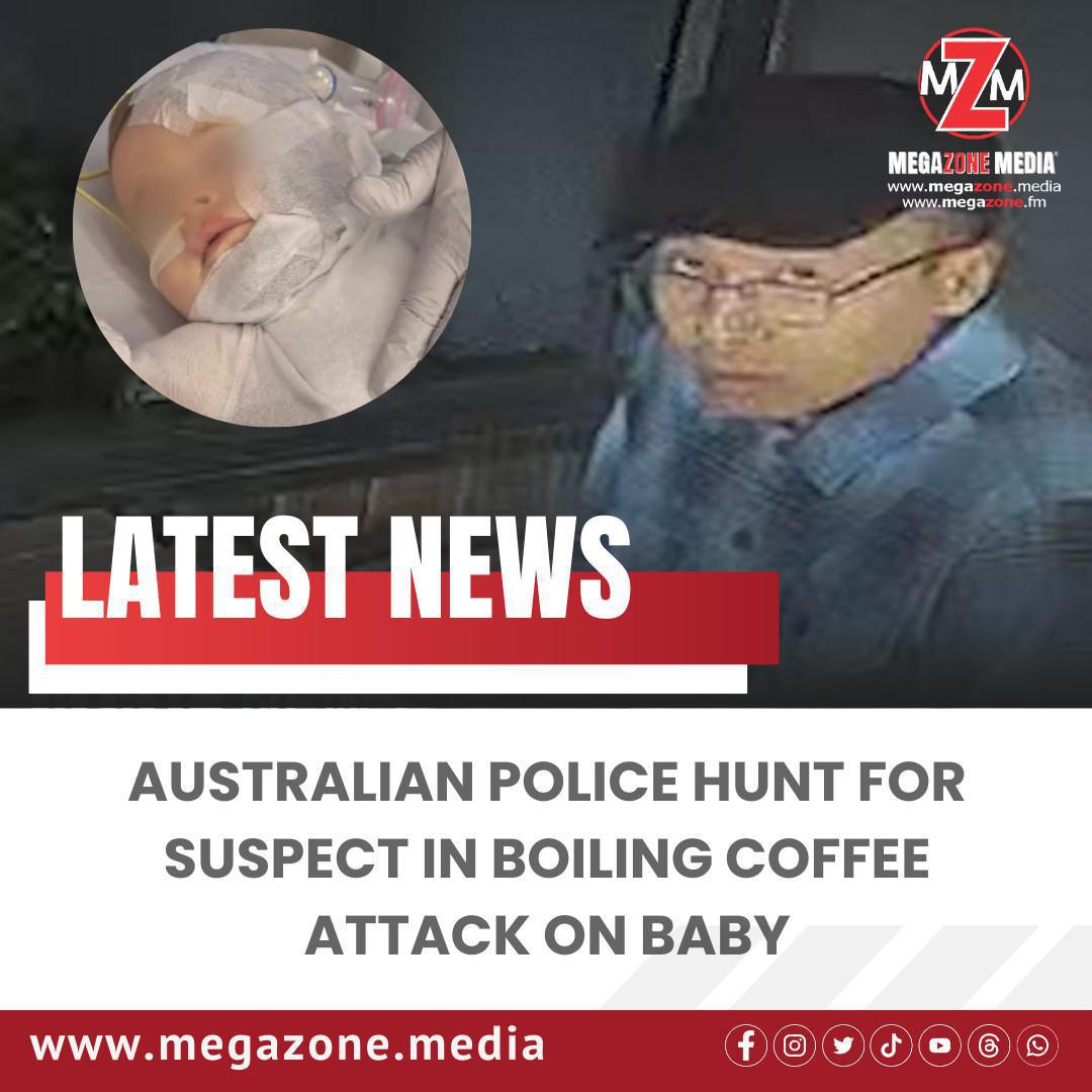 Australian Police Hunt for Suspect in Boiling Coffee Attack on Baby Australian Police Hunt for Suspect in Boiling Coffee Attack on Baby
