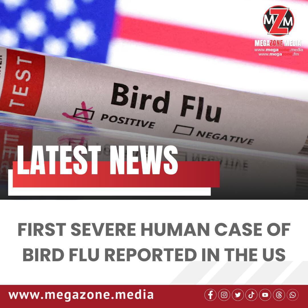 First Severe Human Case of Bird Flu Reported in the US First Severe Human Case of Bird Flu Reported in the US