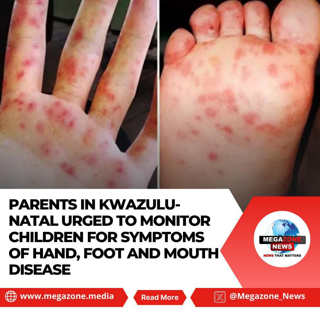 Parents in KwaZulu-Natal Urged to Monitor Children for Symptoms of Hand, Foot and Mouth Disease Parents in KwaZulu-Natal Urged to Monitor Children for Symptoms of Hand, Foot and Mouth Disease