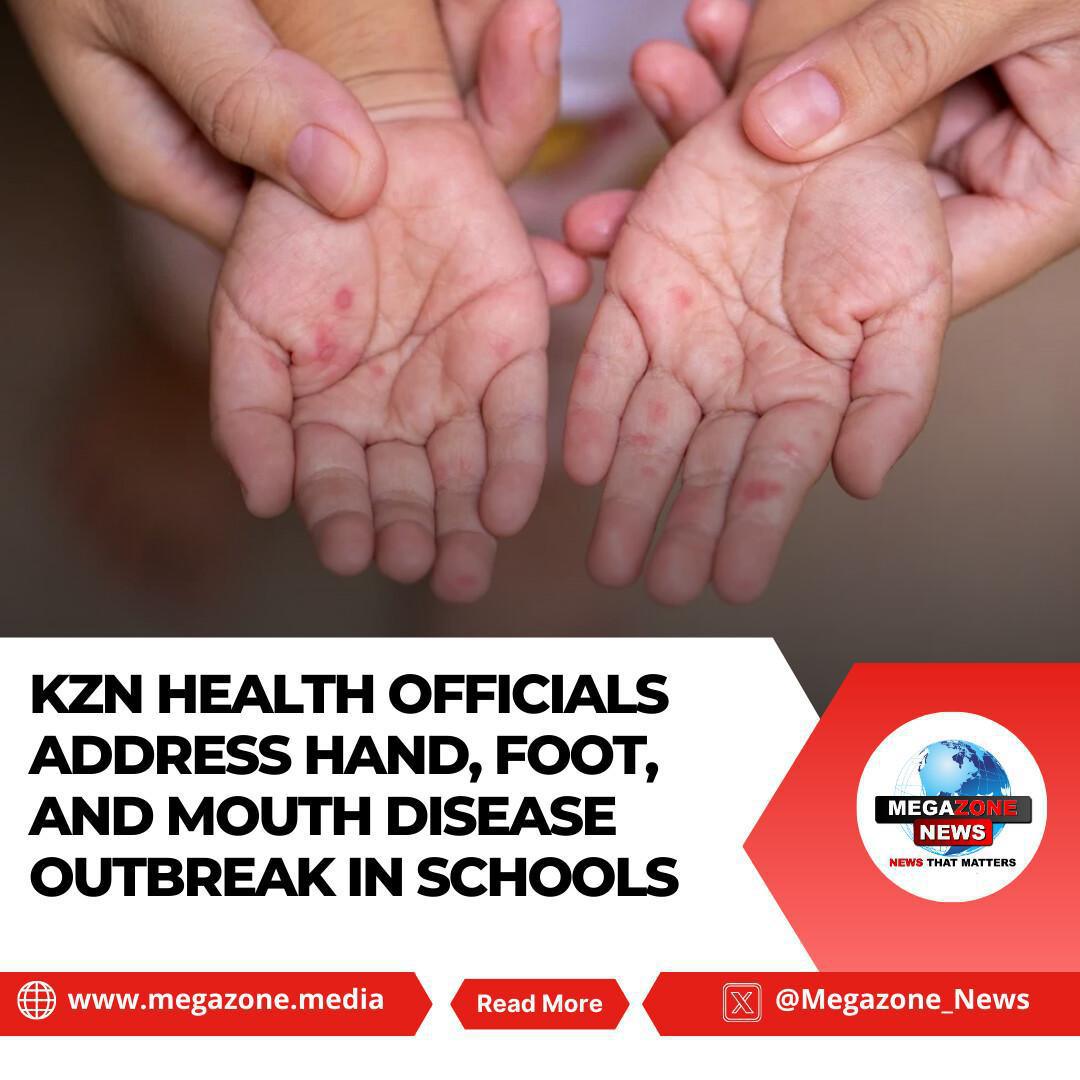 KZN Health Officials Address Hand, Foot, and Mouth Disease Outbreak in Schools