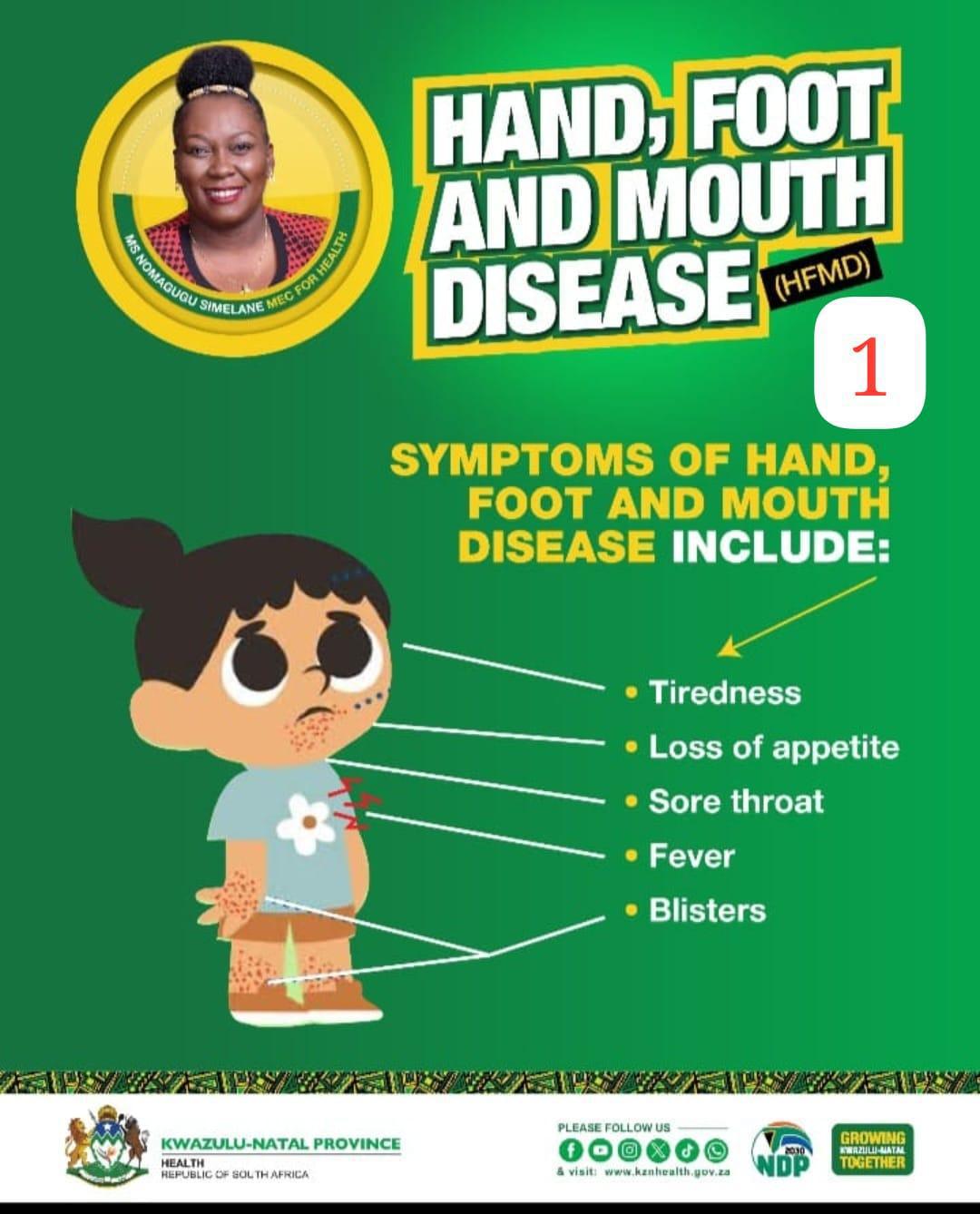 Health Alert: Understanding Hand, Foot, and Mouth Disease