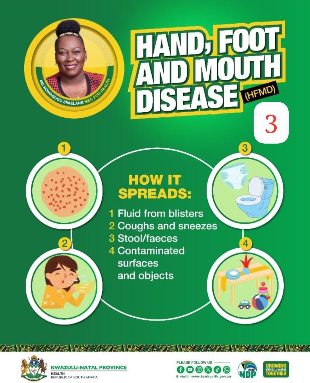 Health Alert: Understanding Hand, Foot, and Mouth Disease