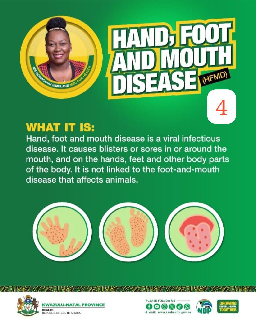 Health Alert: Understanding Hand, Foot, and Mouth Disease