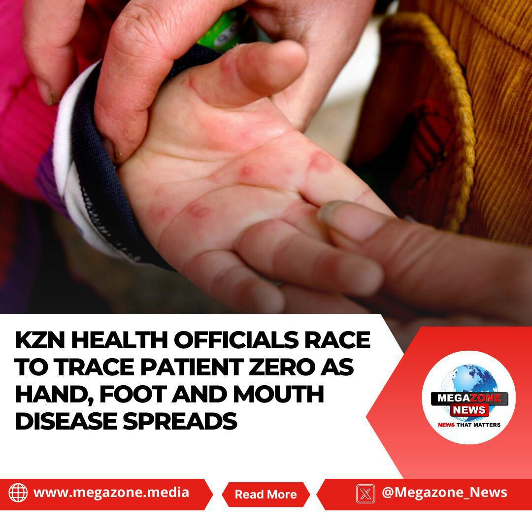 KZN Health Officials Race to Trace Patient Zero as Hand, Foot and Mouth Disease Spreads KZN Health Officials Race to Trace Patient Zero as Hand, Foot and Mouth Disease Spreads