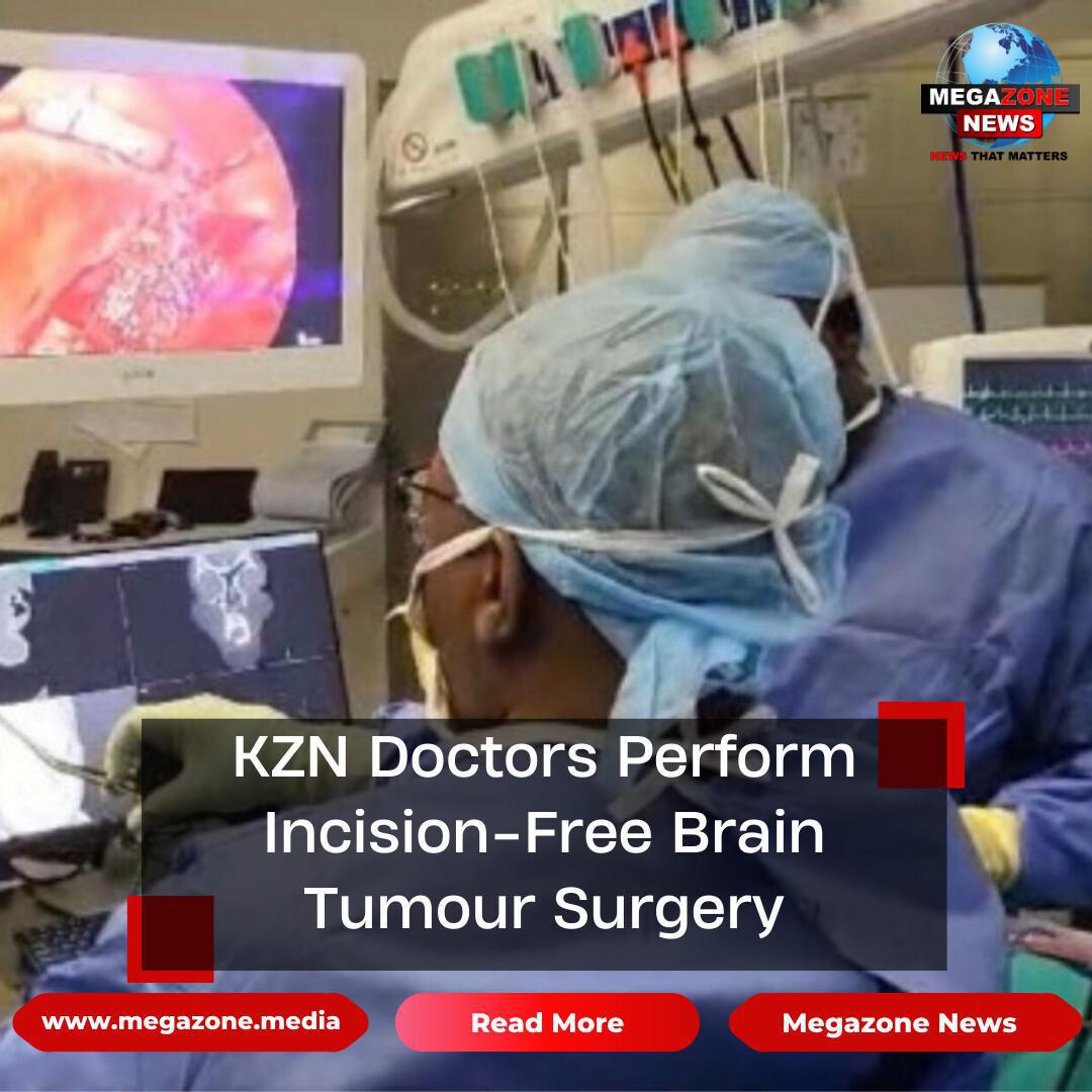 KZN Doctors Perform Incision-Free Brain Tumour Surgery