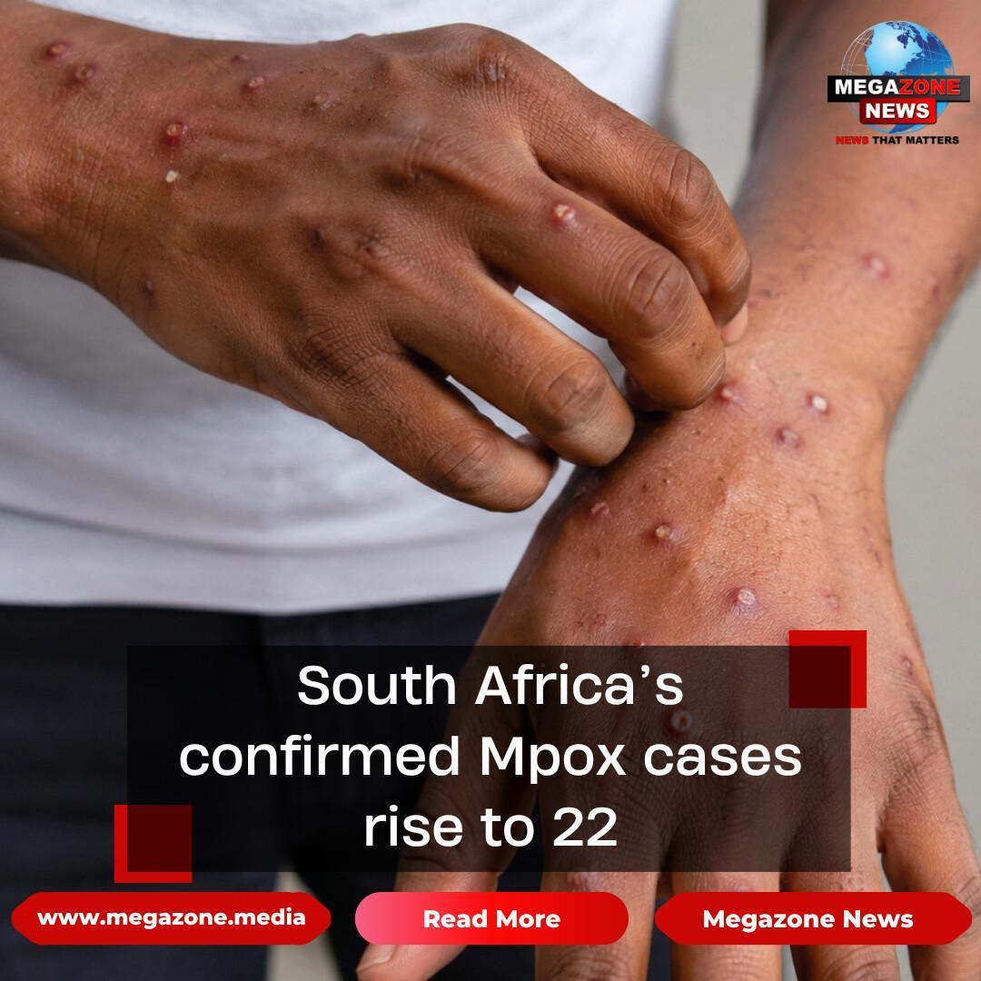 South Africa’s confirmed Mpox cases rise to 22 South Africa’s confirmed Mpox cases rise to 22