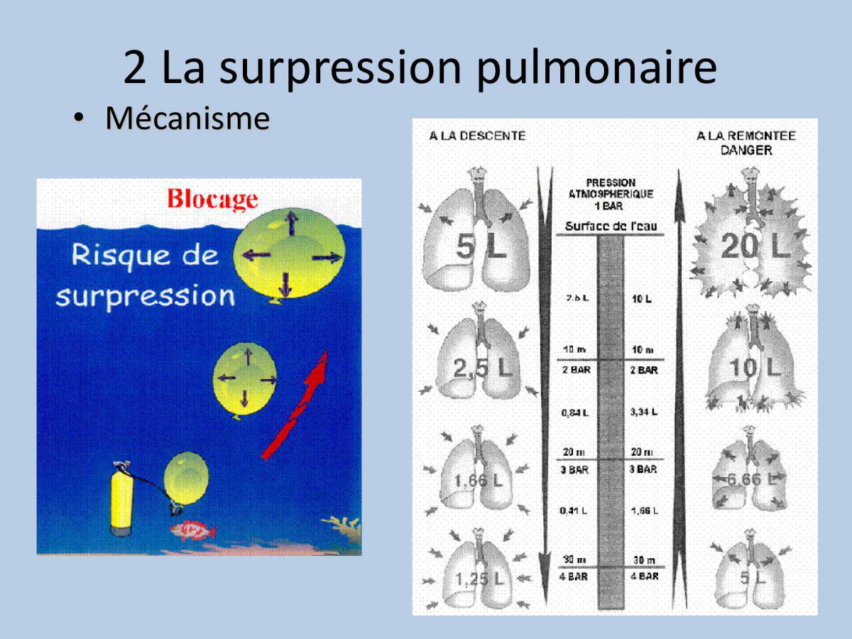 Accident de plongée (FMPA 2022)