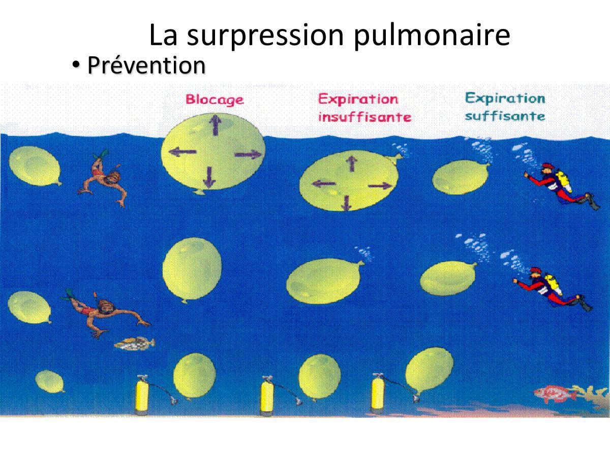 Accident de plongée (FMPA 2022)