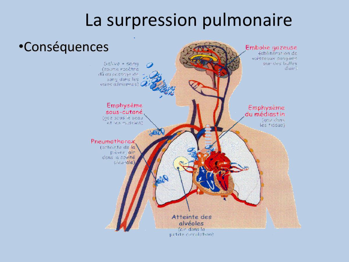 Accident de plongée (FMPA 2022)