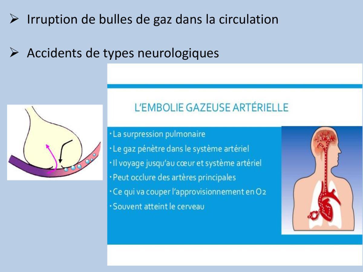Accident de plongée (FMPA 2022)