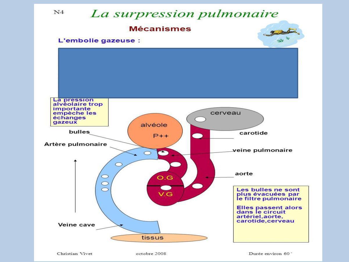 Accident de plongée (FMPA 2022)