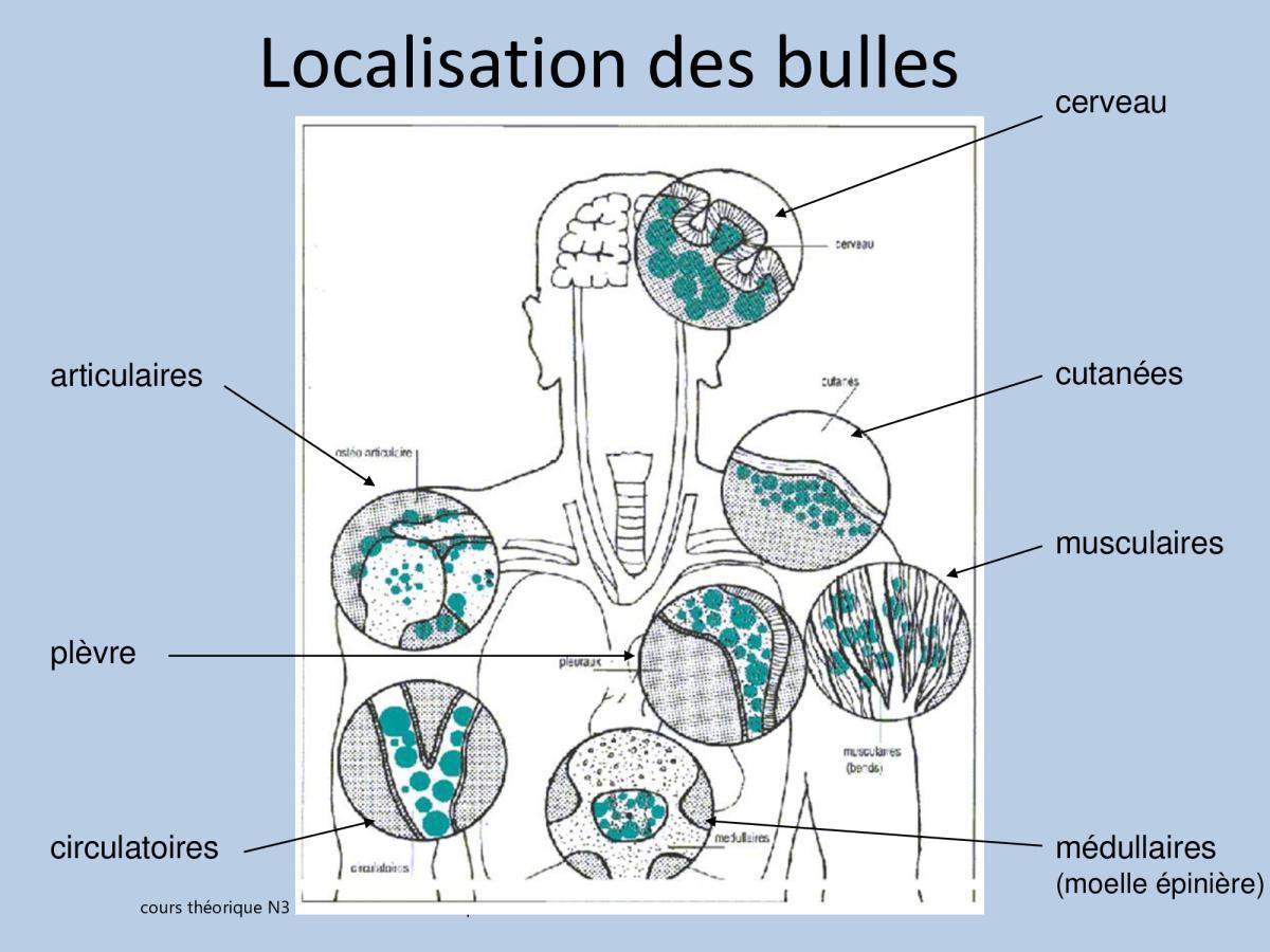 Accident de plongée (FMPA 2022)