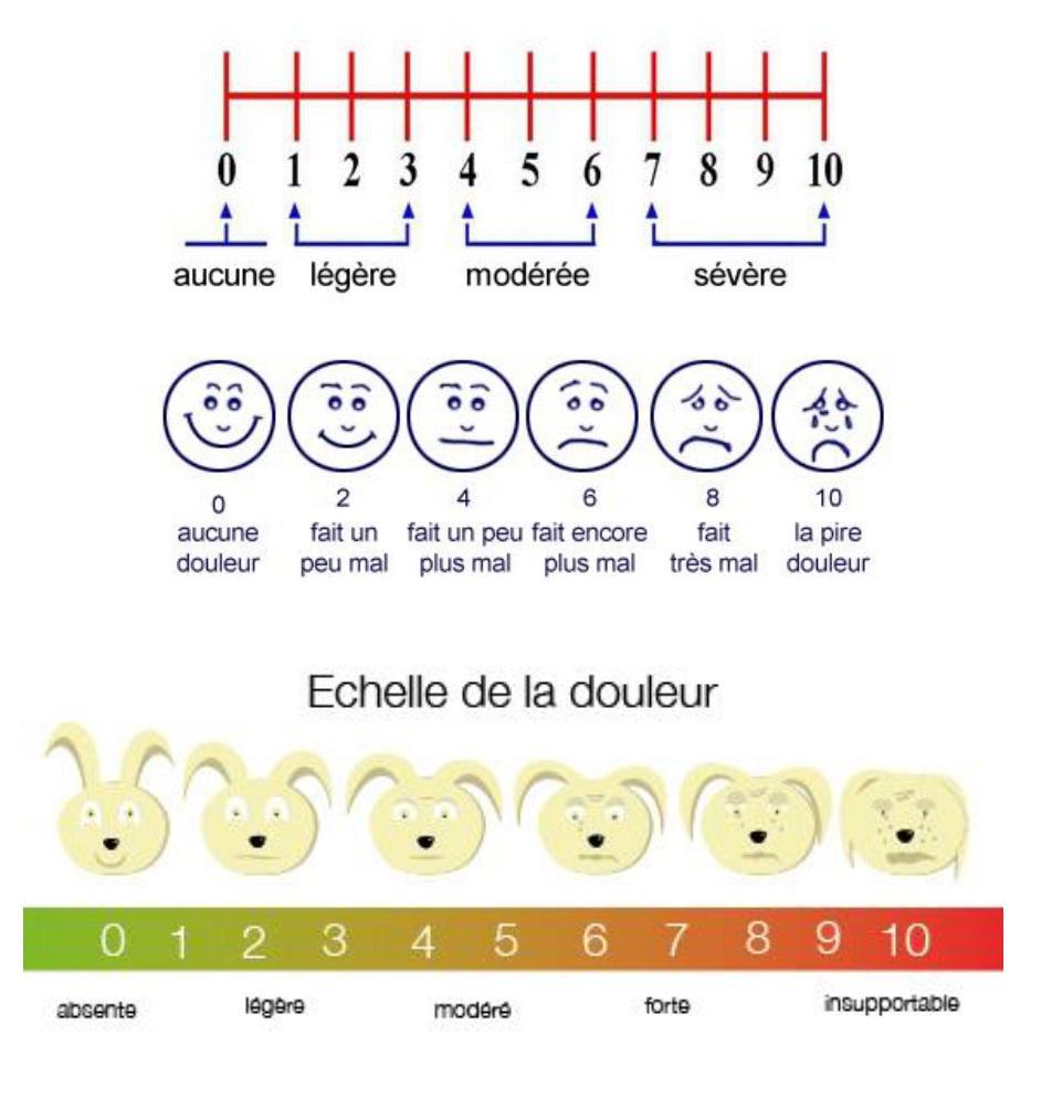 Echelle Douleur