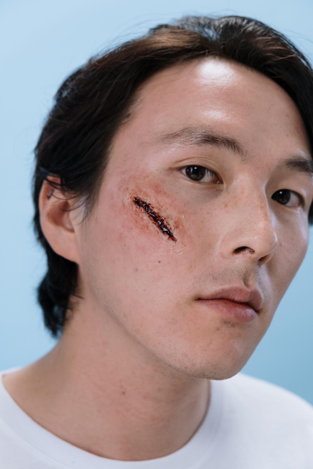 Wir alle haben Wunden Wir alle haben Wunden