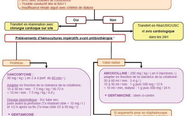 Endocardite infectieuse