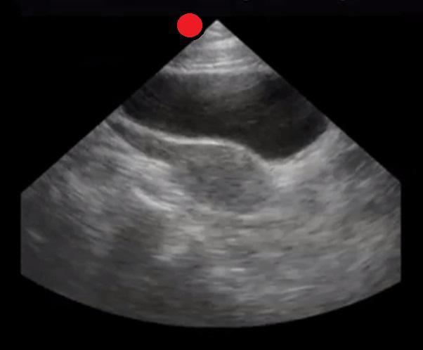Female Pelvis Longitudinal