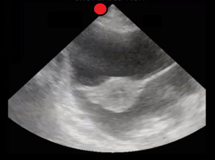 Female Pelvis Transverse
