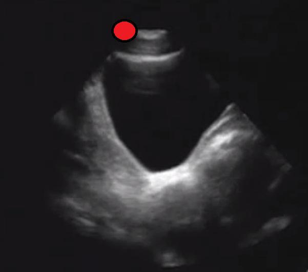 Male Pelvis Longitudinal
