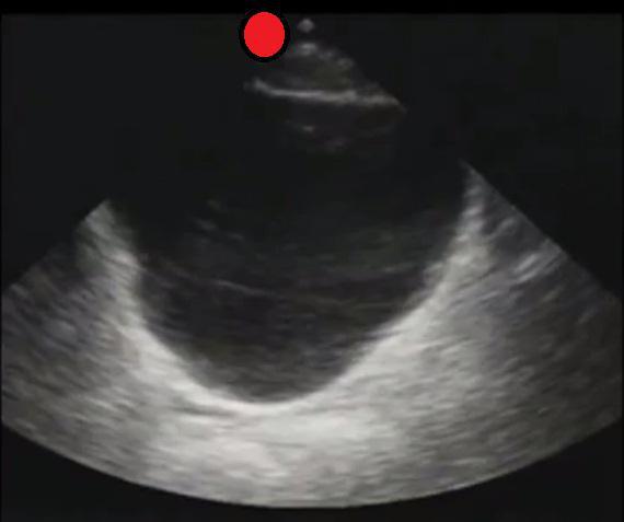 Male Pelvis Transverse