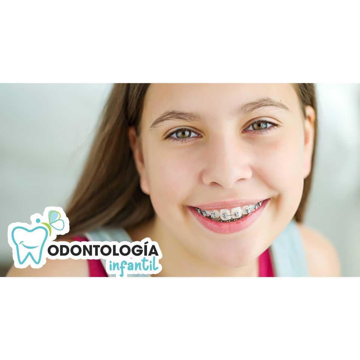 ¿Qué tipos de ortodoncia hay para niños?