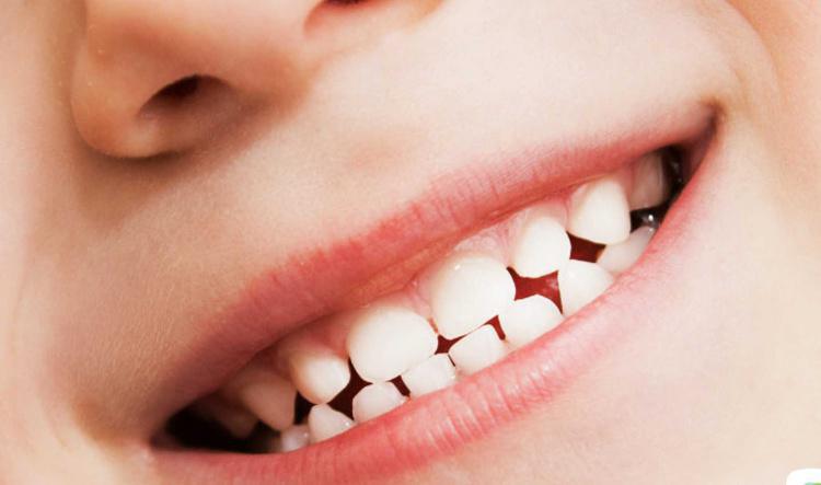La importancia de los dientes de leche