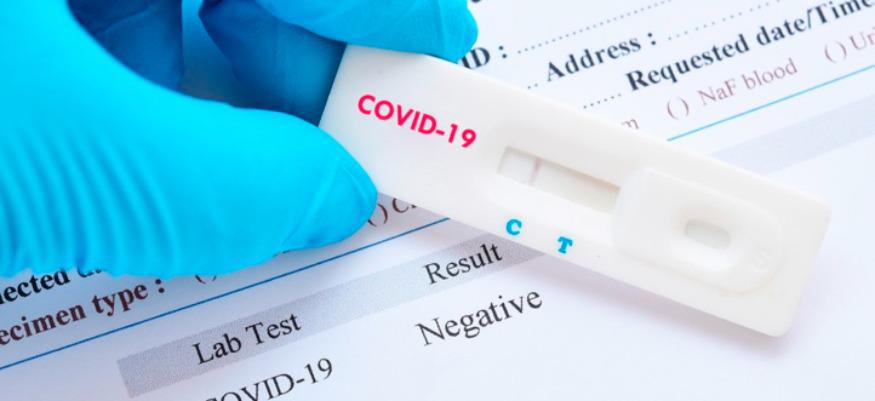L'OMS approuve d’un second test antigénique