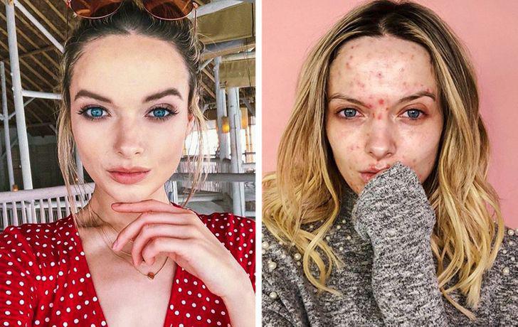 Ce compte Instagram nous montre : Instagram Vs Réalité