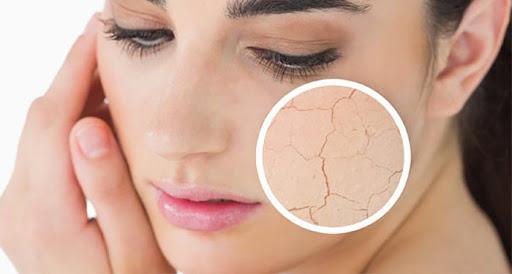 Peau sèche : que faire pour rester hydraté ? 