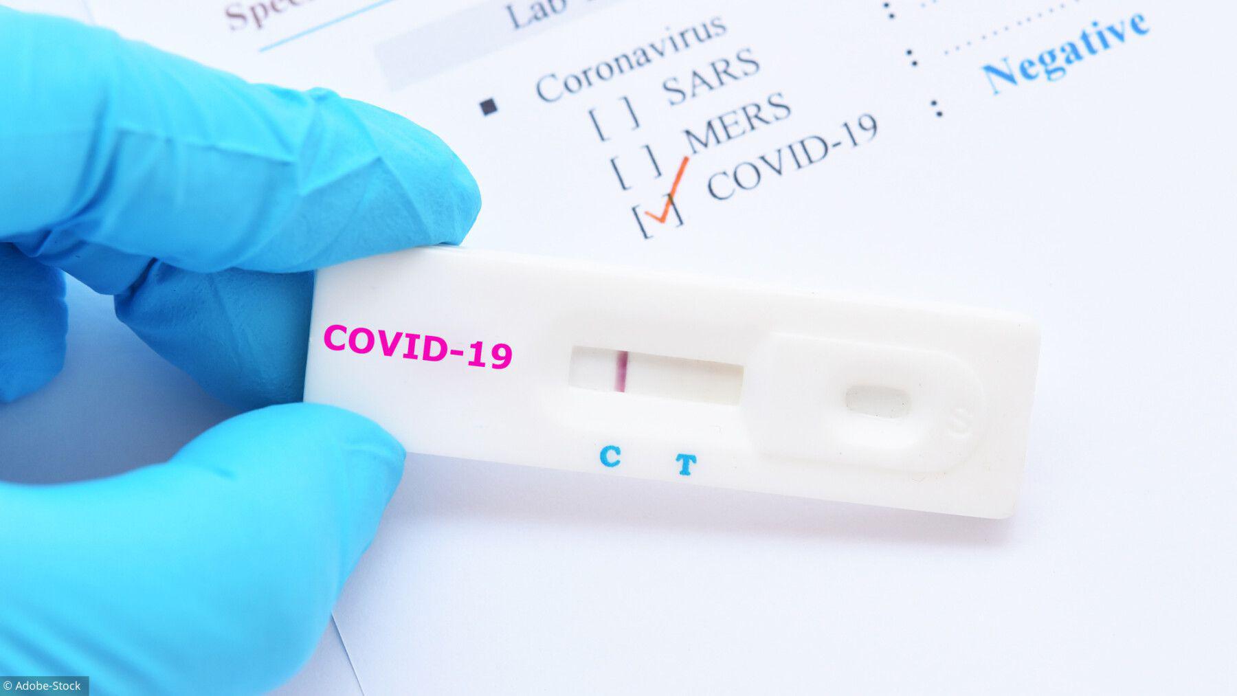 Testé 78 fois positif au Covid, cet homme est à l'isolement depuis 14 mois