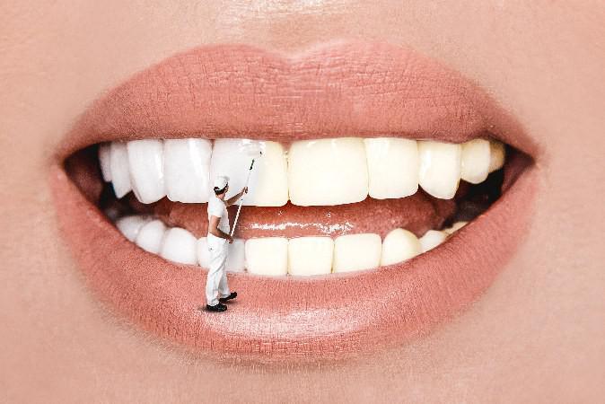 Comment retrouver un sourire éclatant malgré les années ?