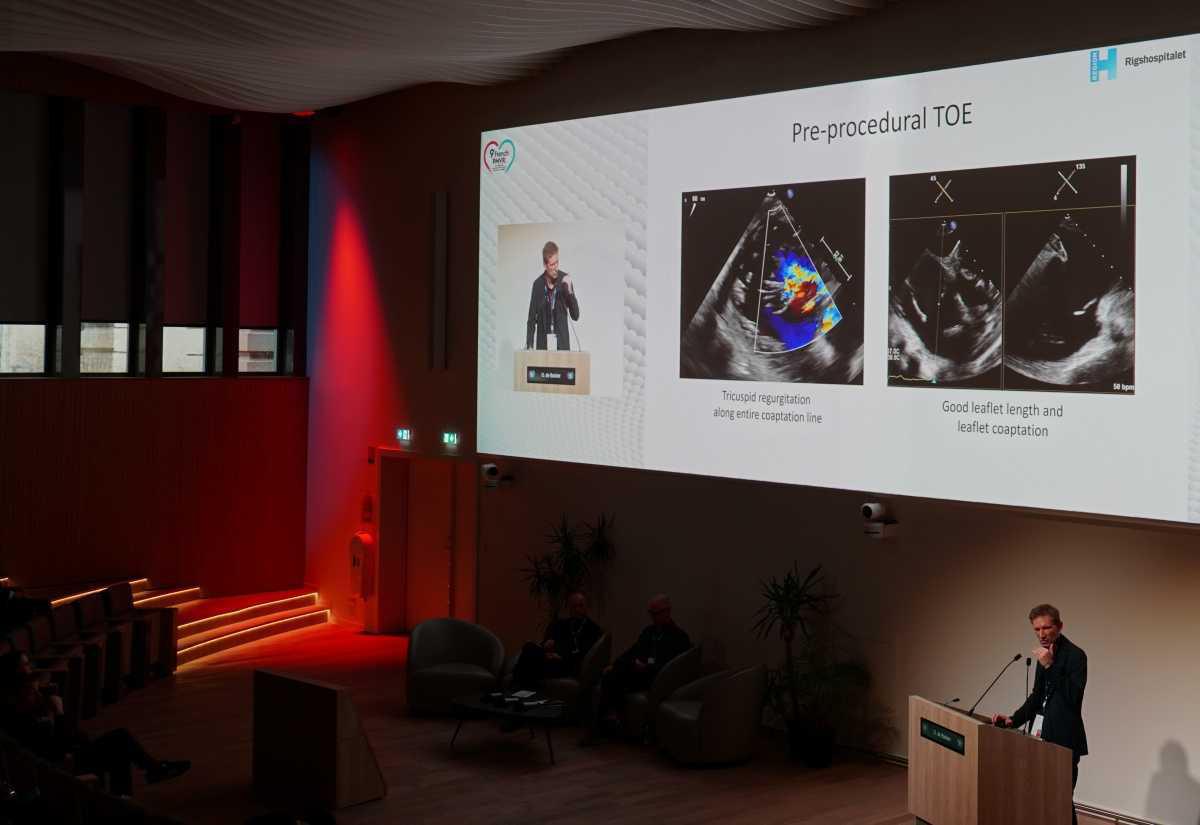 Les équipes de cardiologie des HUS au cœur du 9ᵉ congrès FRENCH PMVR2 - 2025