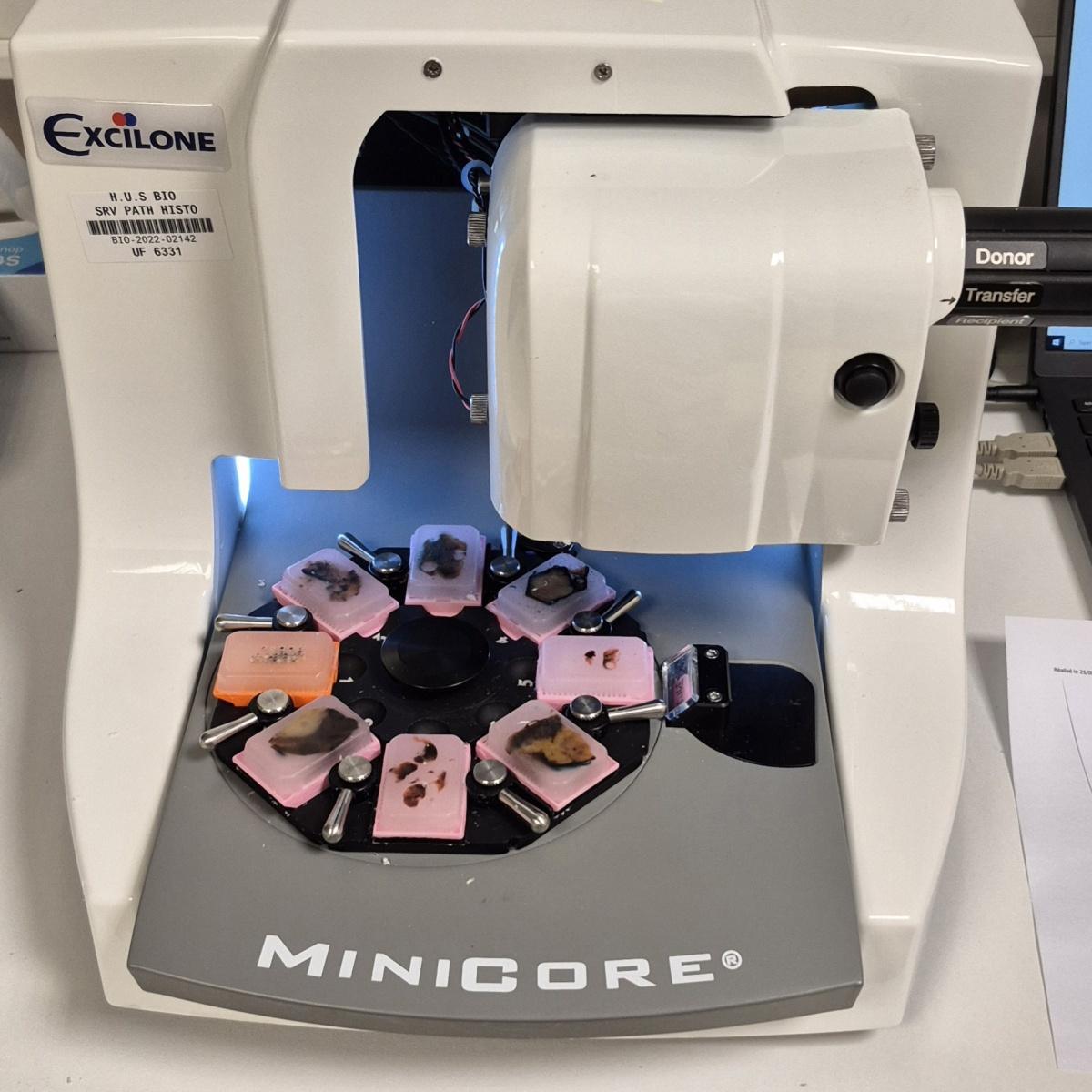 Le Centre de Ressources Biologiques des HUS certifié ISO 20387