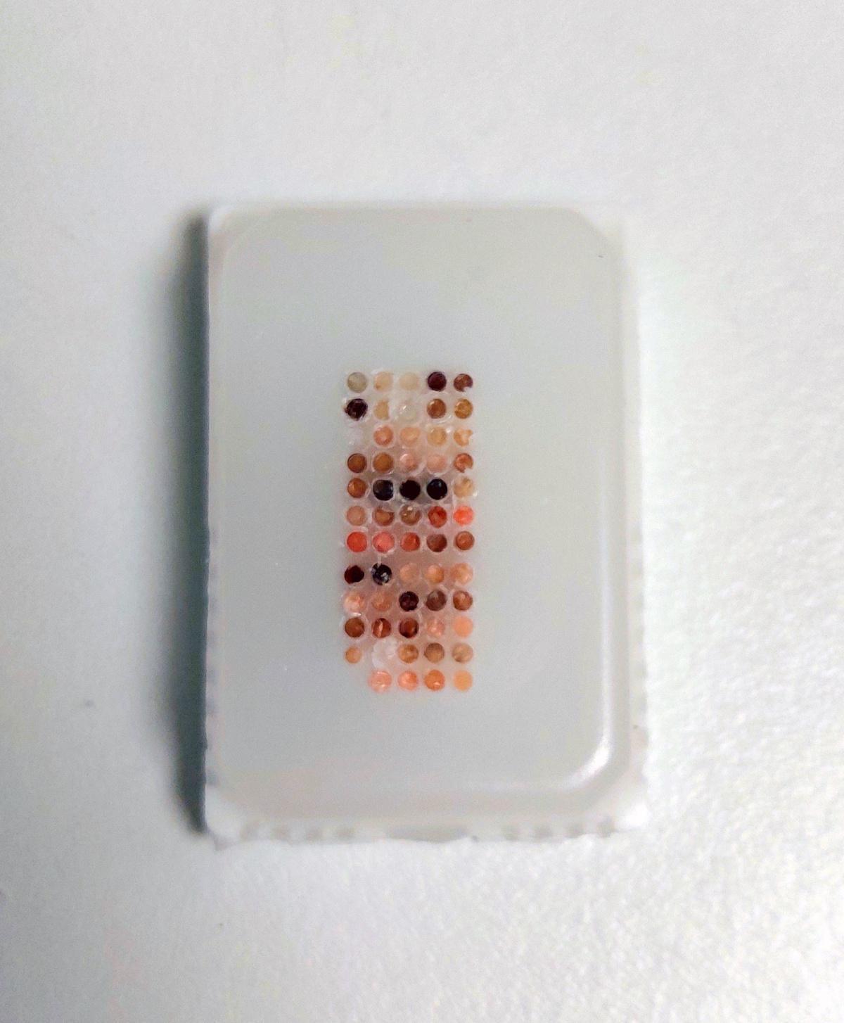 Le Centre de Ressources Biologiques des HUS certifié ISO 20387