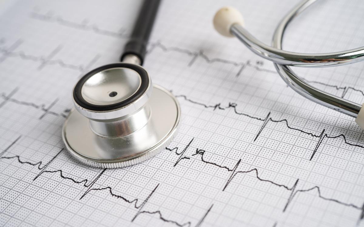 Elettrocardiogramma Elettrocardiogramma