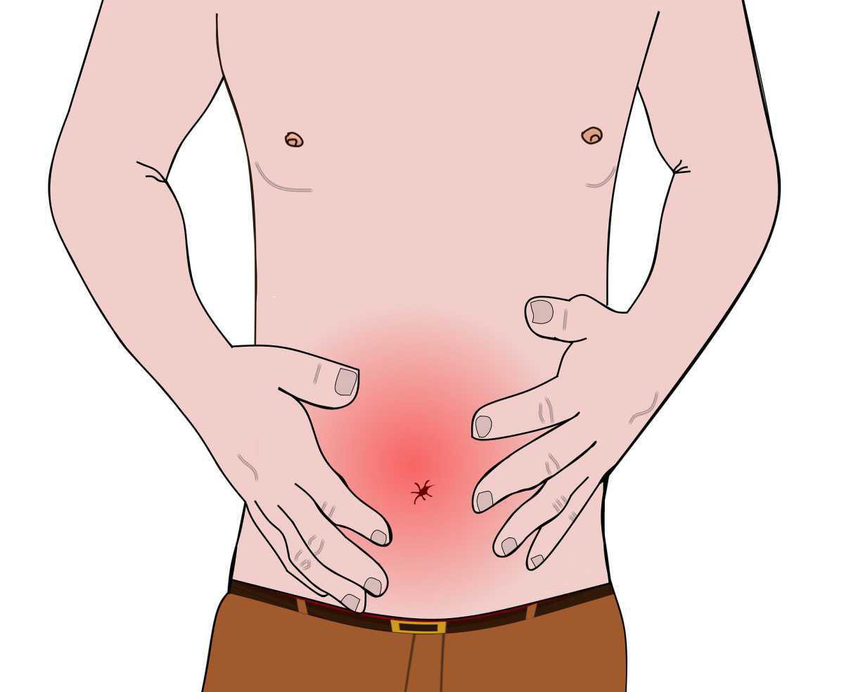 Bladder scann - Volume vessie - Globe