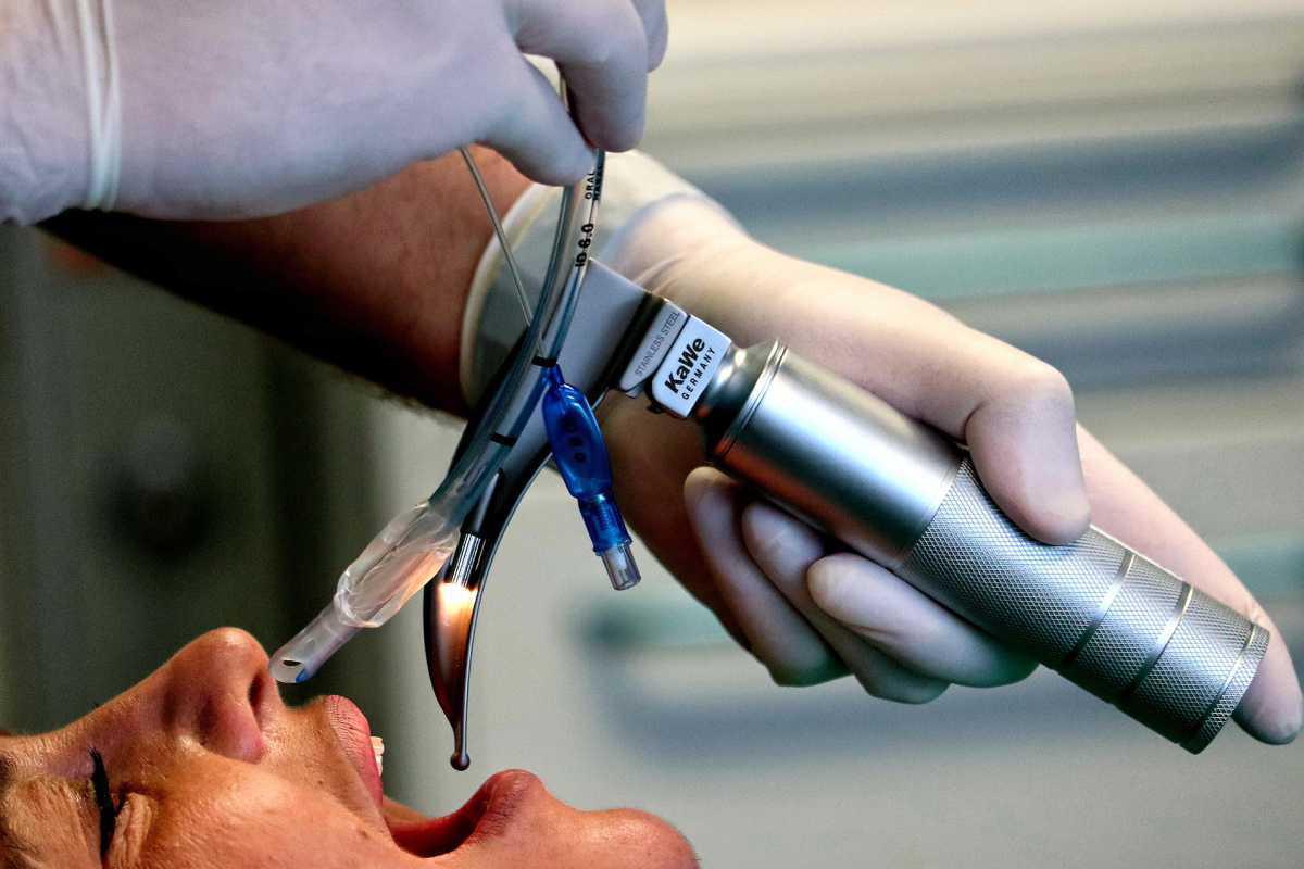 Taille de la sonde d'intubation