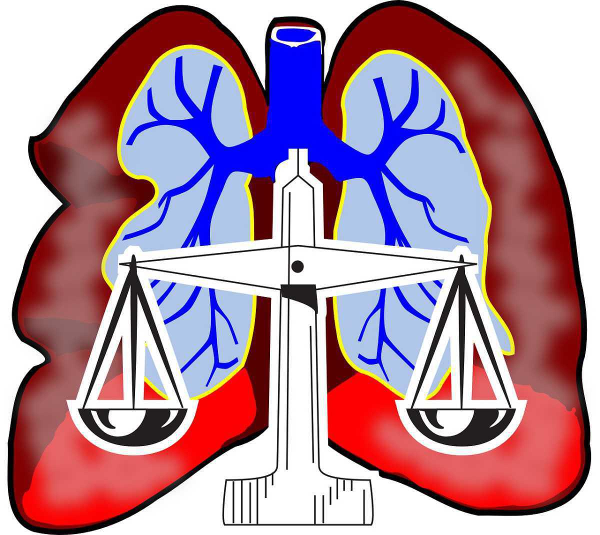 Critères de Light - Epanchement pleural
