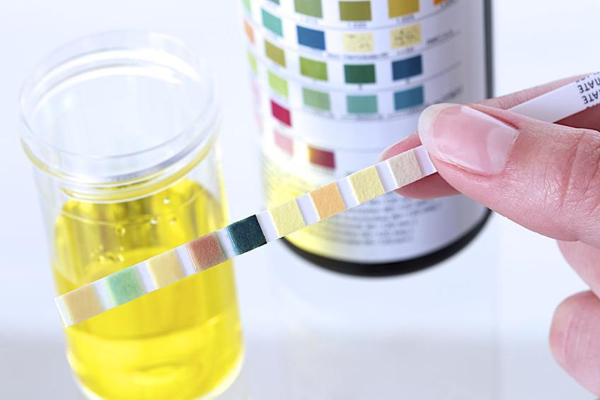 Infections urinaires