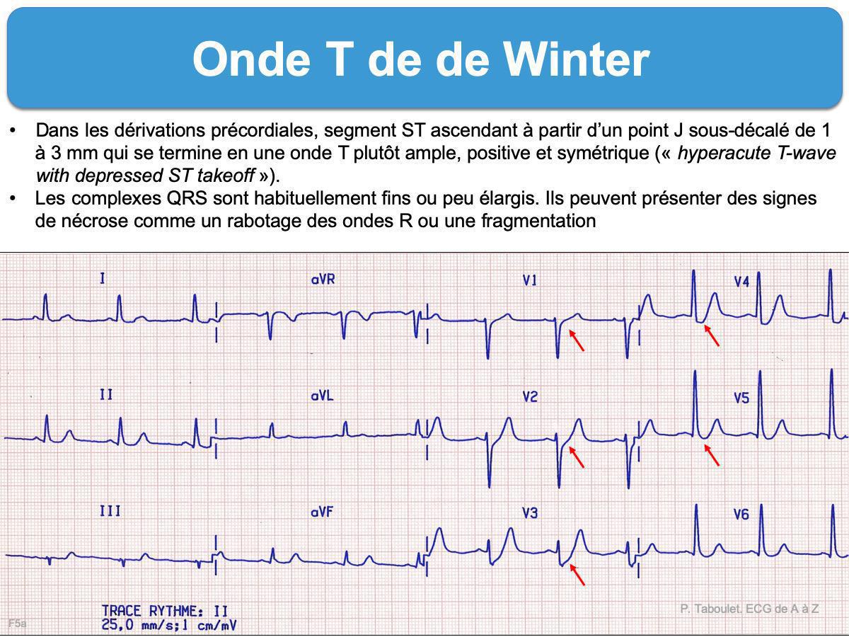 De Winter