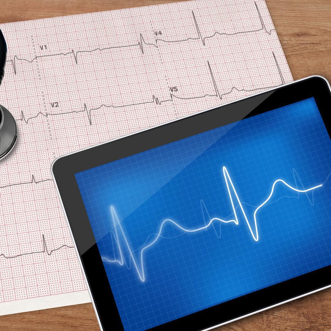 Elettrocardiogramma Elettrocardiogramma