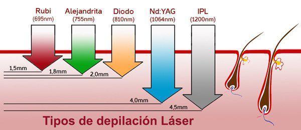 Todo lo que debes sabes sobre la Depilación Láser Medica Todo lo que debes sabes sobre la Depilación Láser Medica