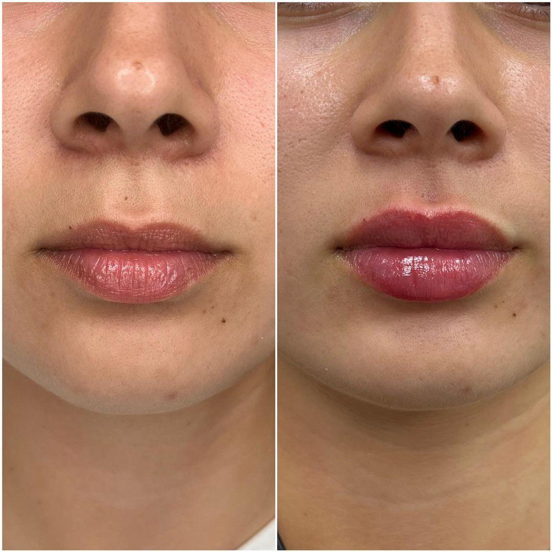 Armonización de Labios