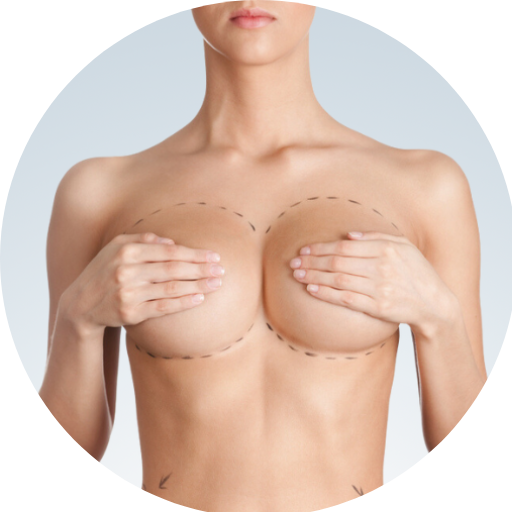 EXPLANTACION STETIK MEDELLIN (1)