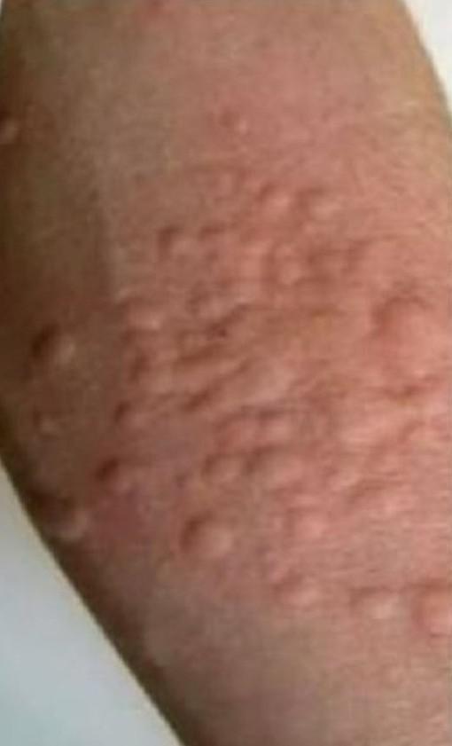 Traitement des chenilles : 12 et 13 novembre 2025 Traitement des chenilles : 12 et 13 novembre 2025