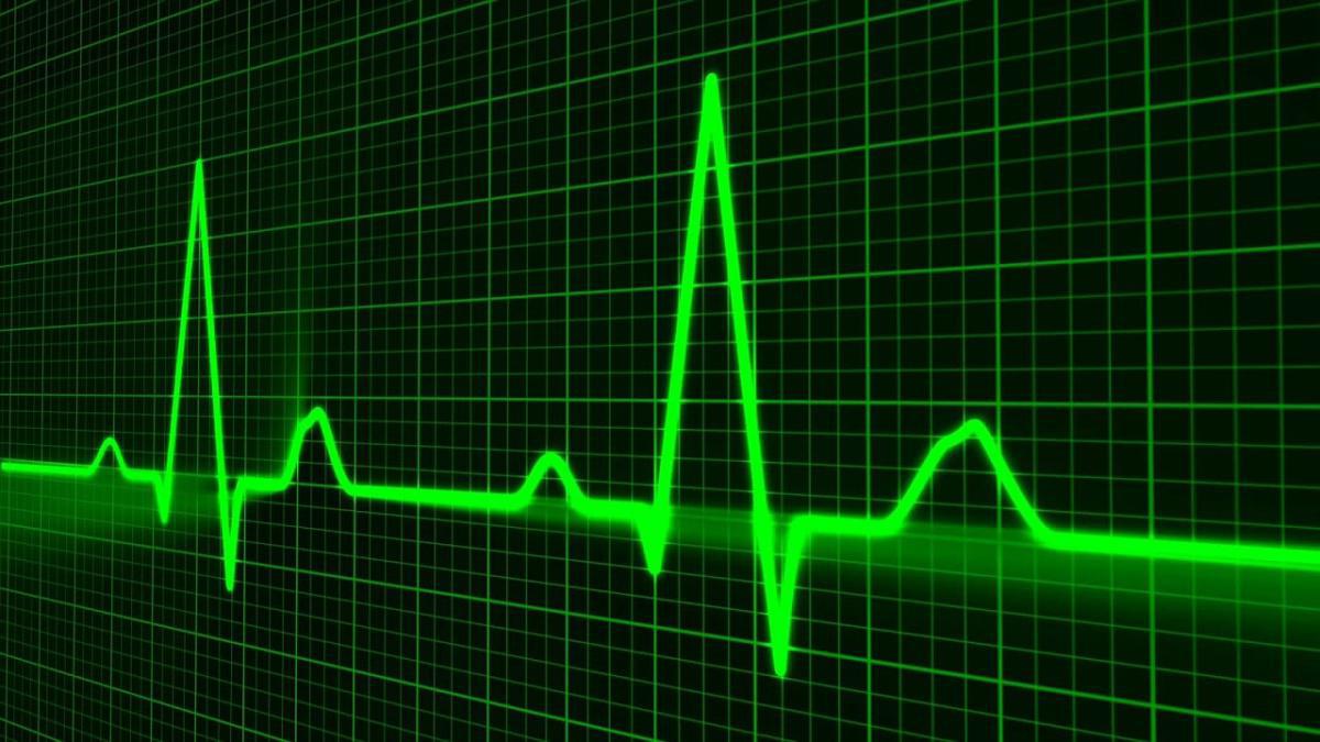 Maladies cardio-vasculaires: un dépistage systématique et précoce est nécessaire, selon l’Institut Choiseul