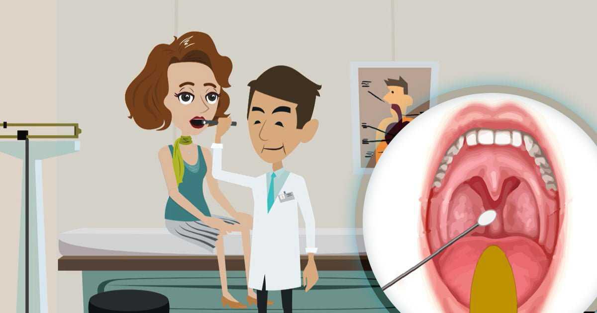 Tampone Streptococco Tampone Streptococco