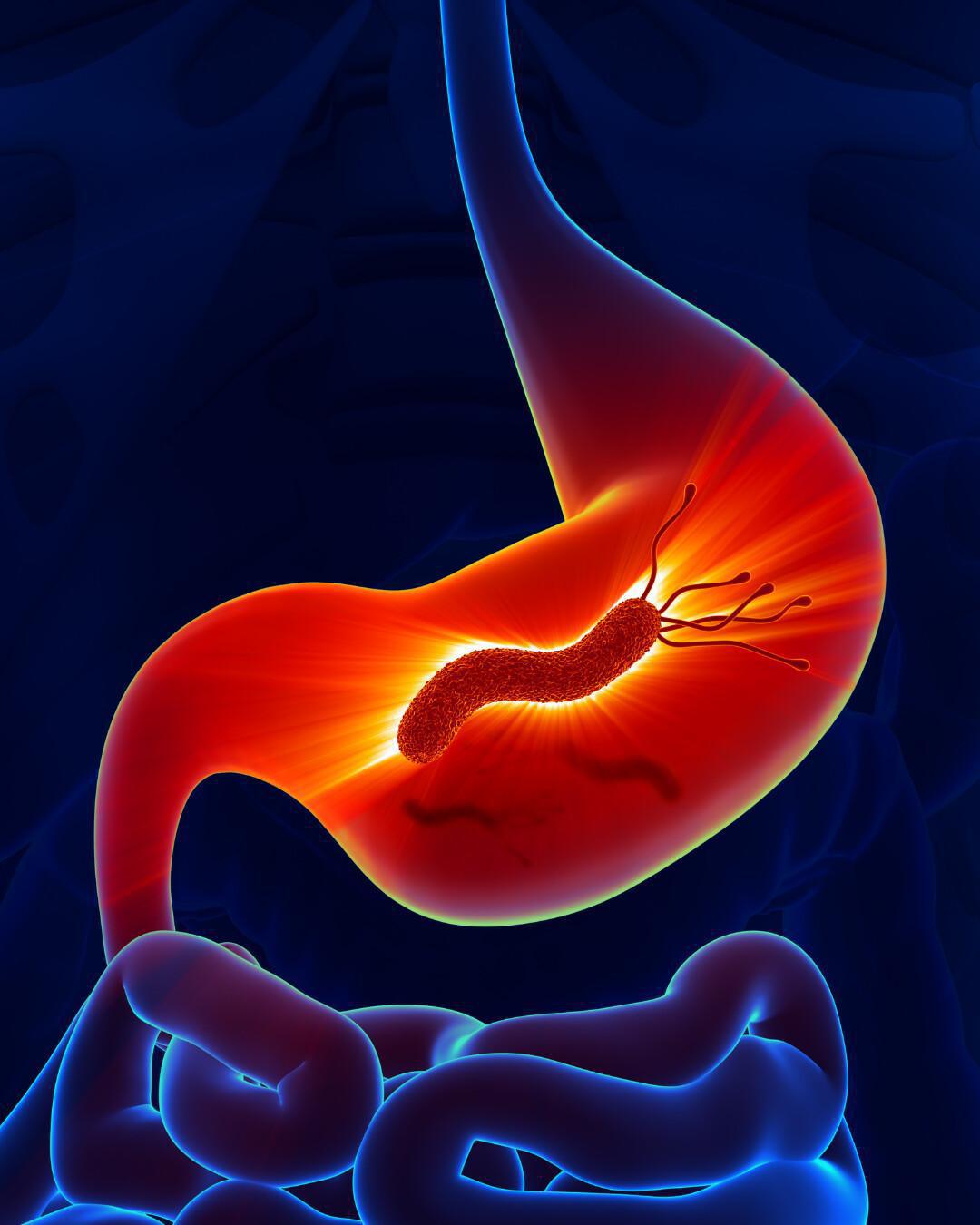 Test Helicobacter Pilory 