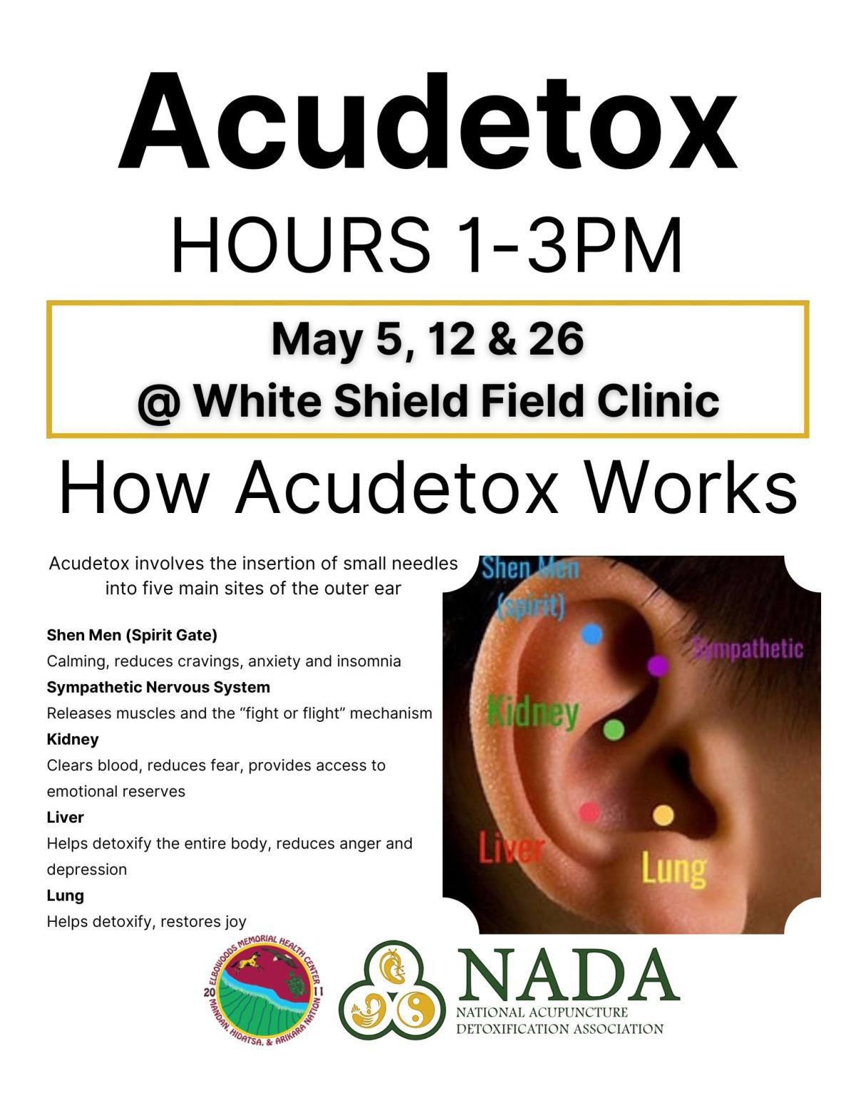 Acudetox