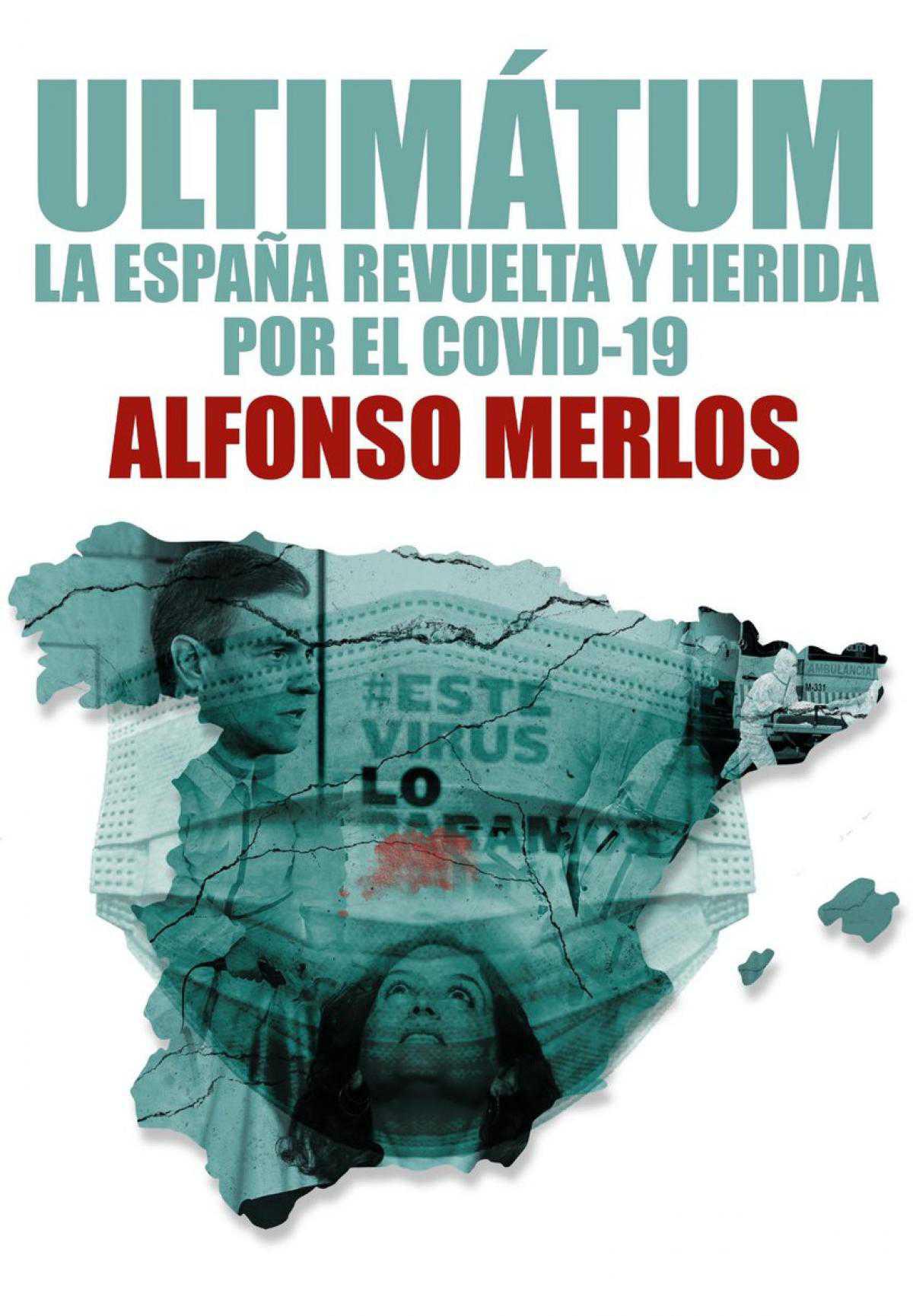 Muy personal... Alfonso Merlos 